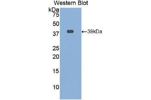 Western blot analysis of the recombinant protein. (Osteocalcin anticorps  (AA 21-99))