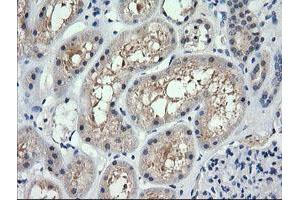 Image no. 1 for anti-Retinoic Acid Receptor Responder (Tazarotene Induced) 1 (RARRES1) antibody (ABIN1500604) (RARRES1 anticorps)