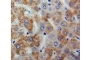IHC-P analysis of Liver tissue, with DAB staining. (C8B anticorps  (AA 161-503))