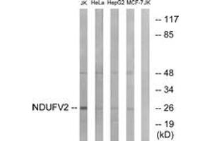 Western blot analysis of extracts from Jurkat/HeLa/HepG2/MCF-7 cells, using NDUFV2 Antibody. (NDUFV2 anticorps  (AA 20-69))