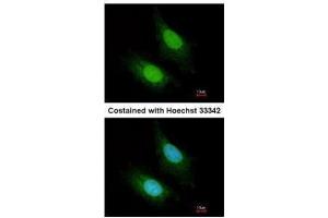 ICC/IF Image Immunofluorescence analysis of paraformaldehyde-fixed HeLa, using ZC3H12A, antibody at 1:200 dilution. (ZC3H12A anticorps)