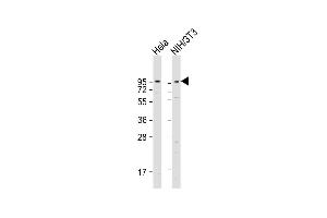 All lanes : Anti-DAG1 Antibody (C-term) at 1:1000-1:2000 dilution Lane 1: Hela whole cell lysate Lane 2: NIH/3T3 whole cell lysate Lysates/proteins at 20 μg per lane.