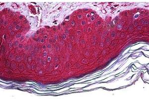 Human Skin: Formalin-Fixed, Paraffin-Embedded (FFPE)