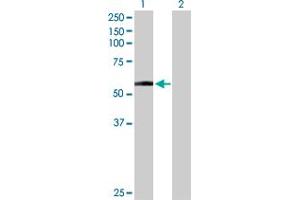 Western Blot analysis of DDC expression in transfected 293T cell line by DDC MaxPab polyclonal antibody. (DDC anticorps  (AA 1-480))