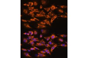 Immunofluorescence analysis of NIH/3T3 cells using  Rabbit pAb (ABIN3021619, ABIN3021620, ABIN3021621 and ABIN6215402) at dilution of 1:100. (Arrestin 3 anticorps  (AA 300-400))