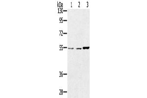 Western Blotting (WB) image for anti-Sestrin 2 (SESN2) antibody (ABIN2433787)