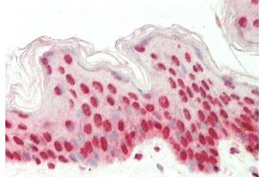 Rabbit Anti-EIF6 antibody Catalog Number: ARP61387 Formalin Fixed Paraffin Embedded Tissue: Human Skin Primary antibody Concentration: 1:100 Secondary Antibody: Donkey anti-Rabbit-Cy3 Secondary Antibody Concentration: 1:200 Magnification: 20x Exposure Time: 0. (EIF6 anticorps  (C-Term))