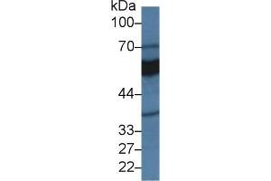 Detection of MAOA in Rat Kidney lysate using Polyclonal Antibody to Monoamine Oxidase A (MAOA) (Monoamine Oxidase A anticorps  (AA 2-497))