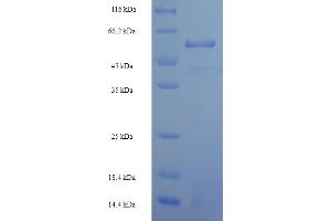 SDS-PAGE (SDS) image for 5-Methyltetrahydrofolate-Homocysteine Methyltransferase (MTR) (AA 923-1265) protein (His-SUMO Tag) (ABIN5711741)