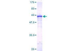 Image no. 1 for F-Box Protein 22 (FBXO22) (AA 1-299) protein (GST tag) (ABIN1353779)