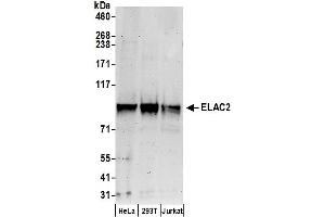 Western Blotting (WB) image for anti-ElaC Homolog 2 (ELAC2) (AA 150-200) antibody (ABIN7455053) (ELAC2 anticorps  (AA 150-200))