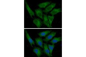 ICC/IF analysis of PAI1 in HeLa cells line, stained with DAPI (Blue) for nucleus staining and monoclonal anti-human PAI1 antibody (1:100) with goat anti-mouse IgG-Alexa fluor 488 conjugate (Green) (PAI1 anticorps  (AA 24-402))