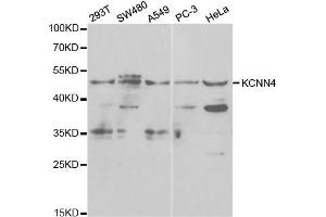 Western blot analysis of extracts of various cell lines, using KCNN4 antibody. (KCNN4 anticorps  (AA 288-427))