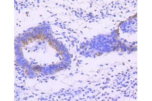 Immunohistochemistry of paraffin-embedded human uterus using Phospho-JNK1/2/3-T183/T183/T221 antibody (abx125450) at dilution of 1/100 (40x lens).
