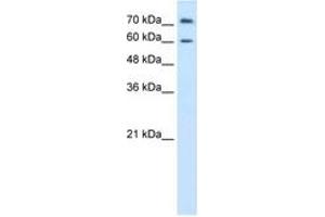anti-Proline Dehydrogenase (Oxidase) 2 (PRODH2) (AA 451-500) antibody