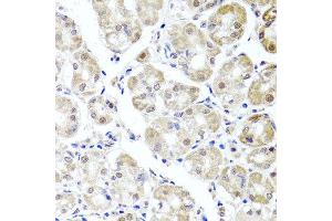 Immunohistochemistry of paraffin-embedded human stomach using ALKBH4 antibody at dilution of 1:100 (x40 lens). (ALKBH4 anticorps)