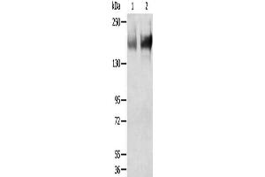Gel: 6 % SDS-PAGE, Lysate: 40 μg, Lane 1-2: Human jejunoileum tissue, Human ileum tissue, Primary antibody: ABIN7192924(TRPM6 Antibody) at dilution 1/200, Secondary antibody: Goat anti rabbit IgG at 1/8000 dilution, Exposure time: 5 minutes