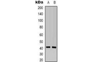 Western blot analysis of MKK6 expression in Hela (A), HEK293T (B) whole cell lysates. (MAP2K6 anticorps  (N-Term))