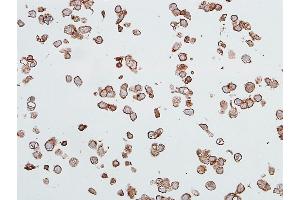 Immunocytochemistry (ICC) image for anti-Carcinoembryonic Antigen-Related Cell Adhesion Molecule 1 (CEACAM1) (AA 35-433) antibody (ABIN7455148) (Recombinant CEACAM1 anticorps  (AA 35-433))