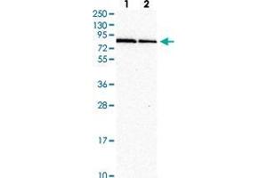 Western blot analysis of Lane 1: Human cell line RT-4 Lane 2: Human cell line U-251MG with RNF10 polyclonal antibody  at 1:250-1:500 dilution. (RNF10 anticorps)