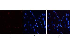 Immunofluorescence analysis of rat heart tissue. (STAT3 anticorps  (pSer727))