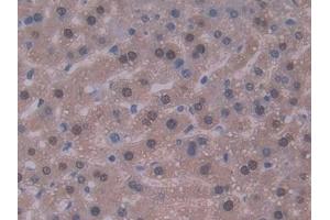 Detection of IL22 in Mouse Liver Tissue using Polyclonal Antibody to Interleukin 22 (IL22) (IL-22 anticorps  (AA 34-179))