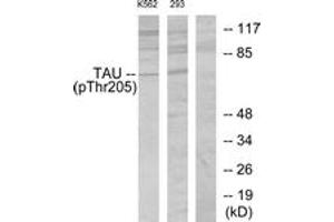 Western blot analysis of extracts from K562 cells and 293 cells, using Tau (Phospho-Thr205) Antibody. (tau anticorps  (pThr522))