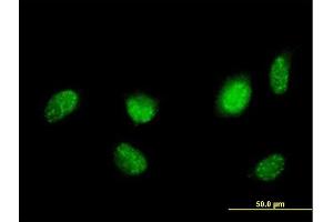 Immunofluorescence of purified MaxPab antibody to HNF4A on HeLa cell. (HNF4A anticorps  (AA 1-464))
