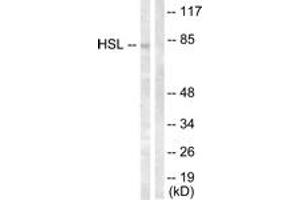 Western blot analysis of extracts from HeLa cells, treated with Calyculin A 100nM 30', using HSL (Ab-554) Antibody. (LIPE anticorps  (AA 520-569))