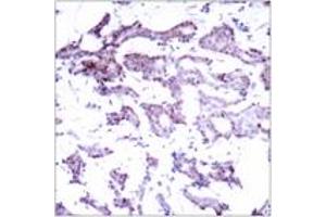 Immunohistochemistry (IHC) image for anti-ELK1, Member of ETS Oncogene Family (ELK1) (AA 356-405) antibody (ABIN2888979) (ELK1 anticorps  (AA 356-405))
