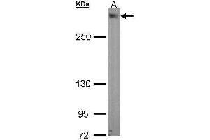 WB Image Sample (30 ug of whole cell lysate) A: A549 5% SDS PAGE antibody diluted at 1:1000 (PDZD2 anticorps  (N-Term))