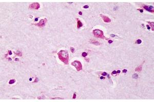 Human Brain: Formalin-Fixed, Paraffin-Embedded (FFPE) (TRAF3 anticorps  (C-Term))