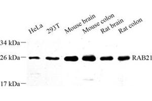 Western blot analysis of RAB21 (ABIN7075341) at dilution of 1: 500 (RAB21 anticorps)