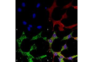 Immunocytochemistry/Immunofluorescence analysis using Mouse Anti-GABA-A Receptor Alpha 4 Monoclonal Antibody, Clone S398A-34 (ABIN2485770).