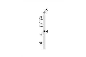 Western blot analysis of lysate from 293T cell line, using HRAS Antibody (Center) (ABIN392183 and ABIN2841894).
