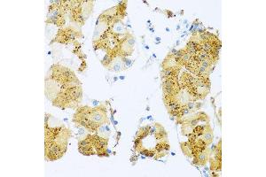 Immunohistochemistry of paraffin-embedded human stomach using ELN antibody at dilution of 1:100 (x40 lens). (Elastin anticorps)