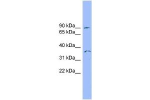 WB Suggested Anti-SDCCAG8 Antibody Titration: 0. (SDCCAG8 anticorps  (N-Term))