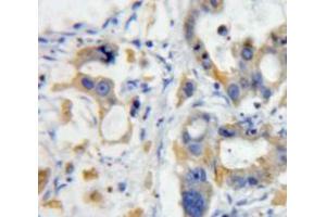 Used in DAB staining on fromalin fixed paraffin-embedded pancreas tissue (TWEAK anticorps  (AA 53-249))