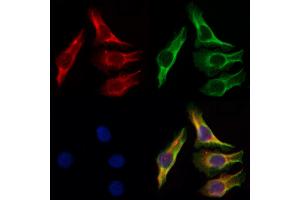 ABIN6257681 and ABIN6274187 staining Hela by IF/ICC.
