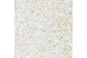 Immunohistochemistry of paraffin-embedded rat ovary using UQCR10 antibody (ABIN6132851, ABIN6149956, ABIN6149958 and ABIN6216272) at dilution of 1:100 (40x lens). (UQCR10 anticorps  (AA 1-63))