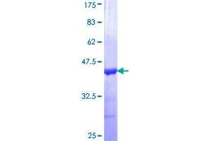 Image no. 1 for Calsequestrin 2 (CASQ2) (AA 21-119) protein (GST tag) (ABIN1348124)