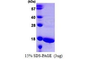 SDS-PAGE (SDS) image for ATP synthase subunit delta, mitochondrial (ATP5F1D) (AA 23-168) protein (His tag) (ABIN6386767)
