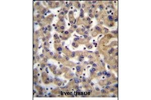PDP1 Antibody (Center) (ABIN656386 and ABIN2845681) immunohistochemistry analysis in formalin fixed and paraffin embedded human liver tissue followed by peroxidase conjugation of the secondary antibody and DAB staining. (PDP anticorps  (AA 308-336))