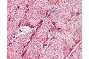 Immunohistochemistry (IHC) image for anti-Acyl-CoA Synthetase Long-Chain Family Member 5 (ACSL5) (C-Term) antibody (ABIN2782881)