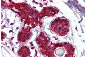 Breast, Human: Formalin-Fixed, Paraffin-Embedded (FFPE)