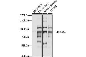 Western blot analysis of extracts of various cell lines, using SLC44 antibody (ABIN7270464) at 1:1000 dilution. (SLC44A2 anticorps  (AA 150-250))