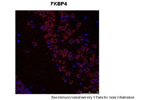 Sample Type: Mouse Brain Slices Red: primaryBlue: DAPIPrimary Dilution: 1:400 Secondary Antibody: Anti-Rabbit IgG Alexa 594Secondary Dilution: 1:400 Image Submitted By: Adahir Labrador-Garrido and Cintia Roodveldt University of Seville