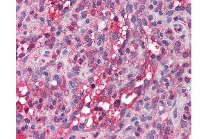 Anti-APOBEC3G antibody IHC of human spleen.