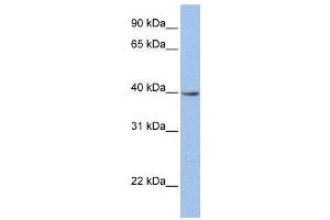 WB Suggested Anti-ZNF202  Antibody Titration: 0. (ZNF202 anticorps  (N-Term))