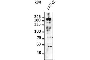 Western Blotting (WB) image for anti-Receptor tyrosine-protein kinase erbB-2 (ErbB2/Her2) (C-Term) antibody (ABIN6254225) (ErbB2/Her2 anticorps  (C-Term))